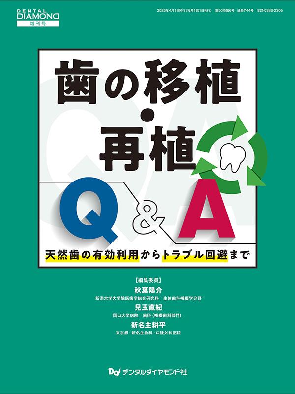 デンタルダイヤモンド増刊号 歯の移植・再植Q&A 天然歯の有効利用からトラブル回避まで